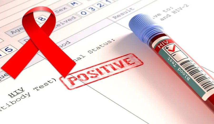 hiv-jpg.jpg