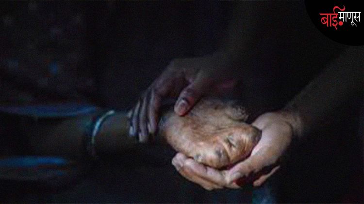 "मी जिंकणार… मी पुन्हा उभं राहणार!"... एका Leprosy Champion ची थरारक आणि हृदयस्पर्शी कथा